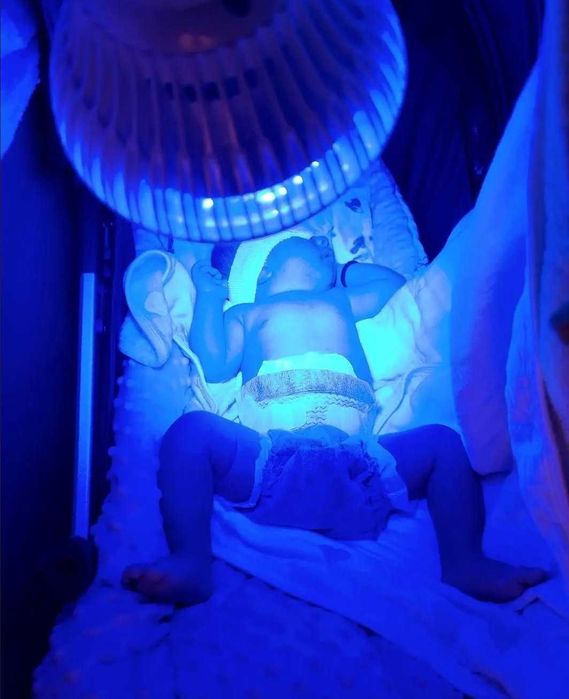 фототерапия дома от желтушки у нов,Фотолампа чакалок сариклигига