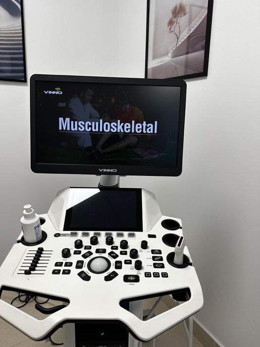 Vând sau închiriez ecograf ViNNO E35 – aproape nou,garanție valabilă