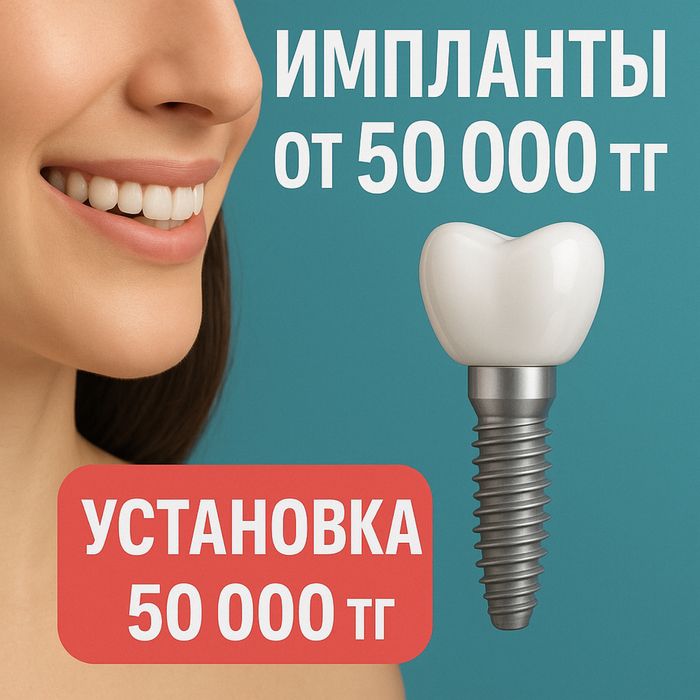 Импланты Астана. Импланты от 50.000