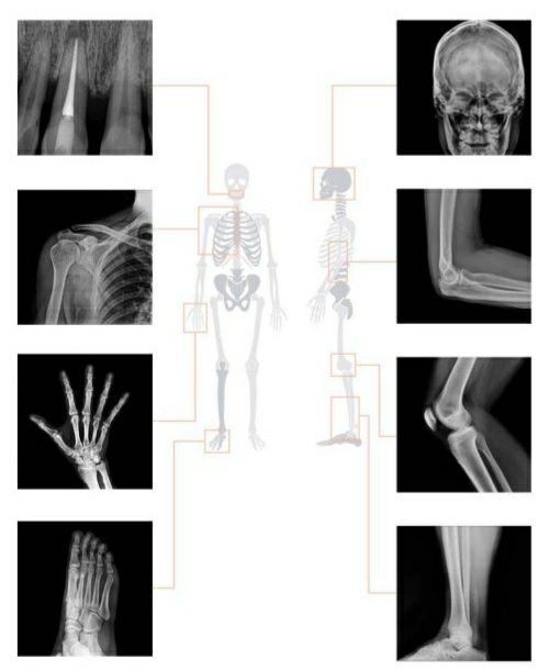 Портативный цифровой рентген аппарат. Mobile X-ray