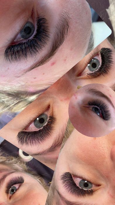 Aplic extensii de gene  1-4D /soft volum / mega volum