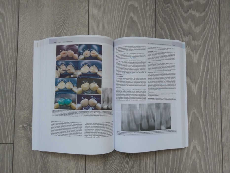 Cohen's Pathways of the Pulp: 12th Edition Engleza