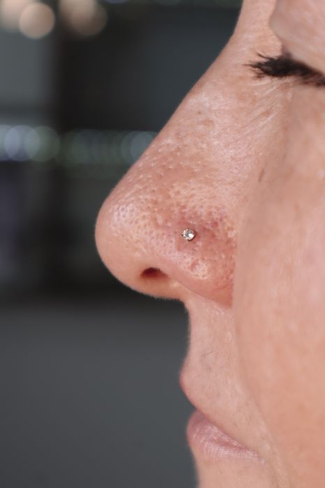 Пирсинг Рудный Прокол ушей