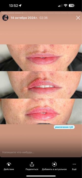 Увеличение губ // Перманент бровей и губ