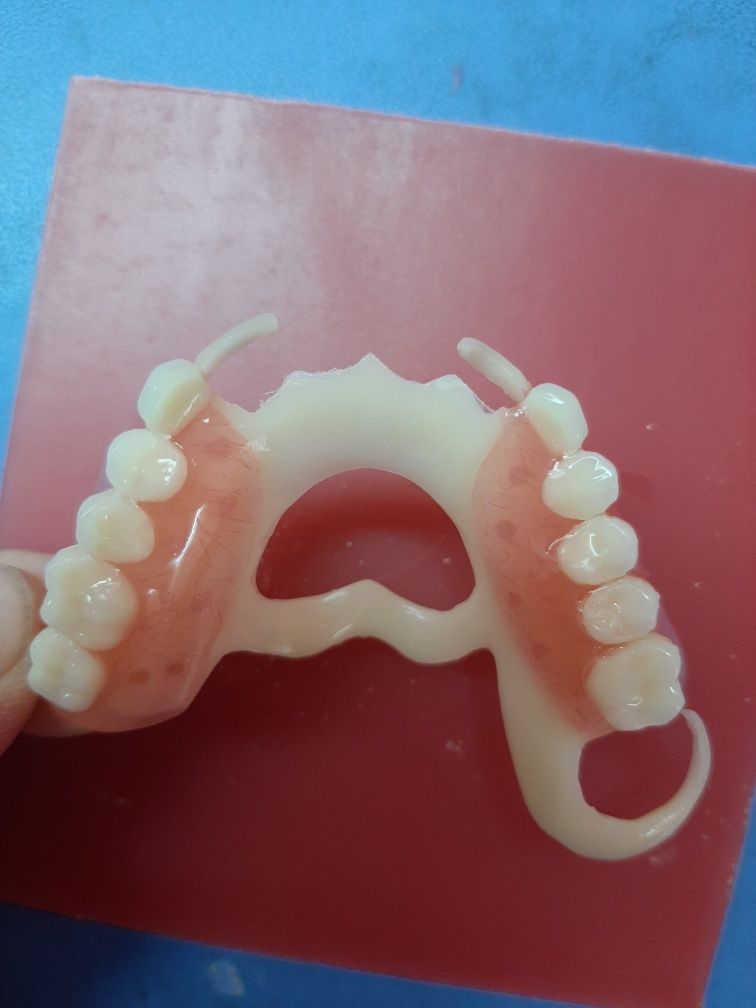 Стоматолог зубной протез