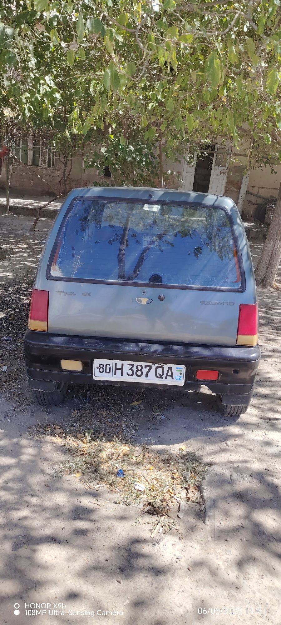 Tico sotiladi holati yaxshi
