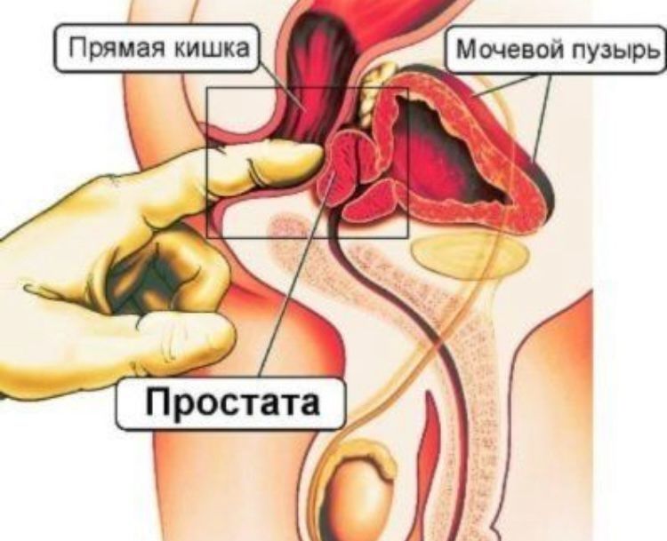 Урологический процедура