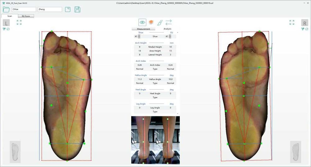 Индивидуальные ортопедические стельки VIVA STEPS