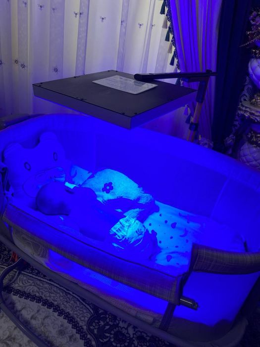 Фотолампа для желтухи. Новорожденным.