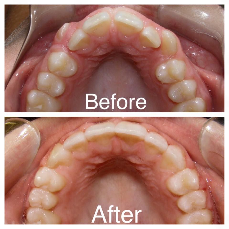 Consultatii gratuite - ortodontie Iasi