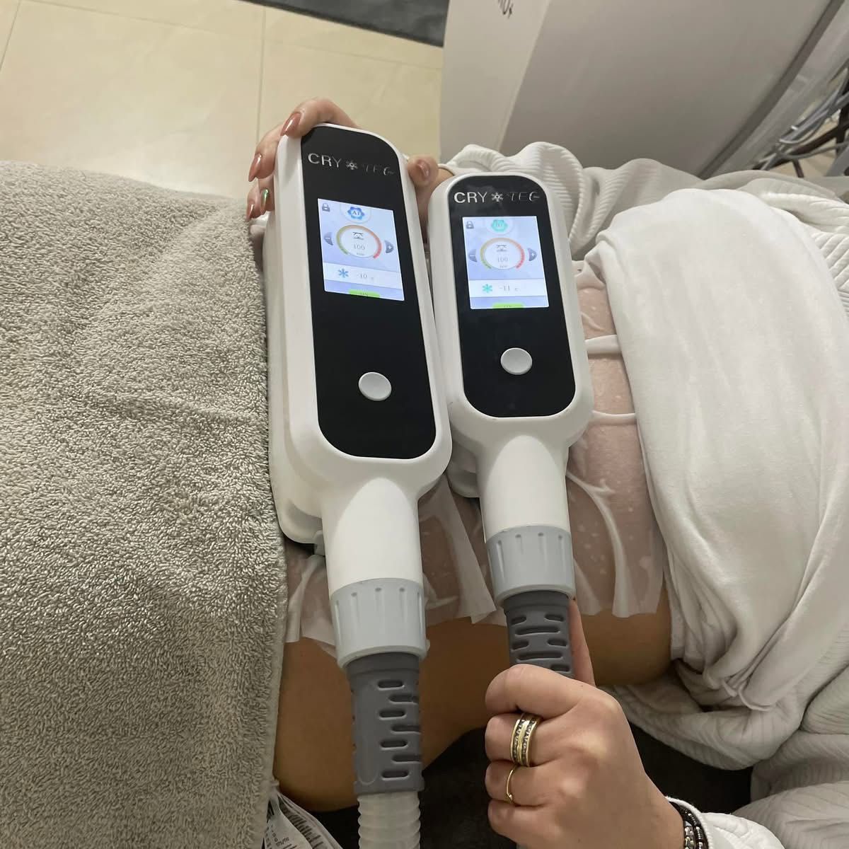 Criolipoliza cryotec 360