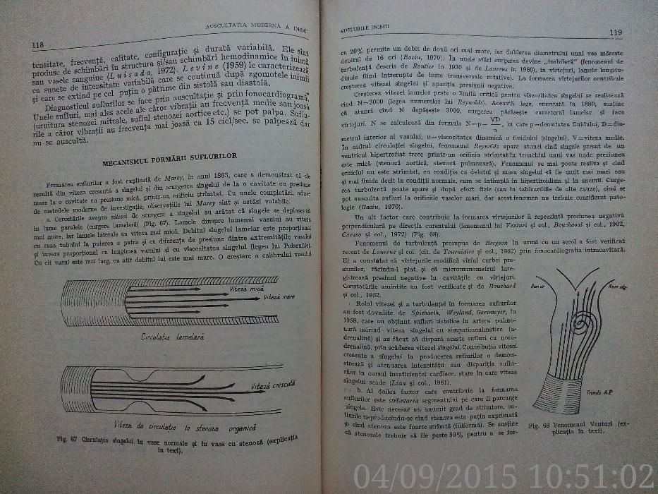 Auscultatia moderna a inimii Stefan Haragus-Ioan Zagreanu, 1974