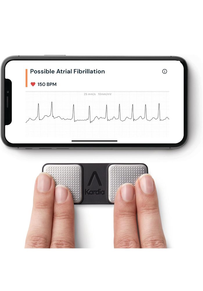 KardiaMobile monitorizare EKG